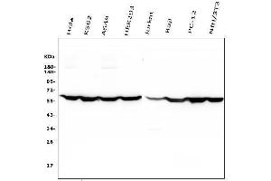 Western blot analysis of PTBP1 using anti-PTBP1 antibody (ABIN7599450).