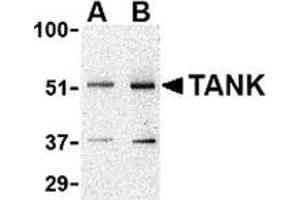 Western blot analysis of TANK in Daudi cell lysate with this product at (A) 0. (TANK 抗体  (N-Term))