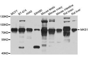 Western Blotting (WB) image for anti-Meckel Syndrome, Type 1 (MKS1) (AA 150-300) antibody (ABIN6143868)