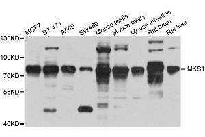 Western blot analysis of extracts of various cell lines, using MKS1 antibody. (MKS1 抗体  (AA 150-300))
