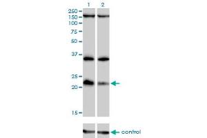 Western blot analysis of DUSP22 over-expressed 293 cell line, cotransfected with DUSP22 Validated Chimera RNAi (Lane 2) or non-transfected control (Lane 1). (DUSP22 抗体  (AA 112-184))