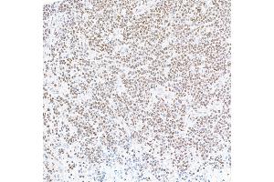 Immunohistochemistry (IHC) image for anti-Forkhead Box P1 (FOXP1) (AA 627-677) antibody (ABIN7454010) (Recombinant FOXP1 抗体  (AA 627-677))