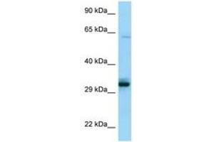 Image no. 1 for anti-Phosphopantothenoylcysteine Synthetase (PPCS) (C-Term) antibody (ABIN6748412) (PPCS 抗体  (C-Term))