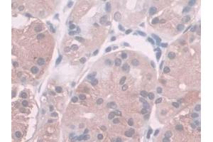 Immunohistochemistry (IHC) image for anti-serine Peptidase Inhibitor, Kunitz Type, 2 (SPINT2) (AA 28-197) antibody (ABIN7436417)