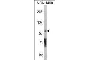 DGKQ Antibody  (ABIN392717 and ABIN2842188) western blot analysis in NCI- cell line lysates (35 μg/lane). (DGKQ 抗体  (C-Term))