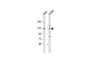 All lanes : Anti-DIS3 Antibody (Center) at 1:1000 dilution Lane 1: Hela whole cell lysate Lane 2: Jurkat whole cell lysate Lysates/proteins at 20 μg per lane. (DIS3 抗体  (AA 295-323))