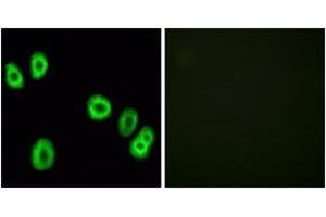 Immunofluorescence analysis of HuvEc cells, using GPR18 Antibody. (GPR18 抗体  (AA 191-240))