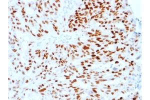 Immunohistochemistry (IHC) image for anti-Estrogen Receptor 1 (ESR1) antibody (ABIN6939339)