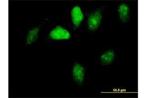 Immunofluorescence of purified MaxPab antibody to GNL1 on HeLa cell. (GNL1 抗体  (AA 1-607))