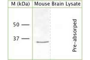 WB on mouse brain lysate (denatured, reduced) using Rabbit antibody to n-terminal region of OLIG2 (Oligo2, bHLHB1, RACK17): IgG (ABIN350657) at a concentration of 30 µg/ml. (OLIG2 抗体  (AA 80-130))