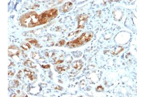 Immunohistochemistry (IHC) image for anti-Secretoglobin, Family 2A, Member 2 (SCGB2A2) antibody (ABIN6940036)