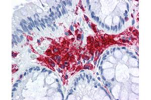Anti-MHC Class II DQ DR Polymorphic antibody IHC of human colon. (MHC Class II DQ/DR 抗体 (FITC))