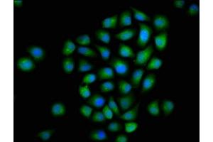 Immunofluorescence staining of Hela cells with ABIN7160643 at 1:133, counter-stained with DAPI. (MTMR2 抗体  (AA 1-173))