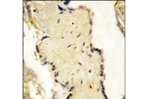 Formalin-fixed and paraffin-embedded placenta tissue reacted with SPPL2a Antibody (N-term), which was peroxidase-conjugated to the secondary antibody, followed by DAB staining. (SPPL2A 抗体  (N-Term))
