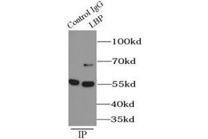 Immunoprecipitation (IP) image for anti-Lipopolysaccharide Binding Protein (LBP) antibody (ABIN5870819) (LBP 抗体)