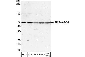 Western Blotting (WB) image for anti-Thyroid Hormone Receptor Interactor 4 (TRIP4) (AA 225-275) antibody (ABIN7450846) (TRIP4 抗体  (AA 225-275))