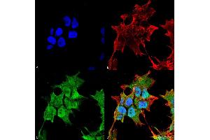 Immunocytochemistry/Immunofluorescence analysis using Mouse Anti-SUR1 Monoclonal Antibody, Clone S289-16 . (ABCC8 抗体  (AA 1548-1582))