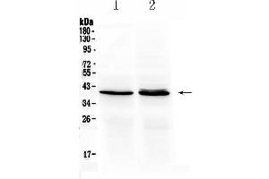 Western blot analysis of OTC using anti- OTC antibody . (OTC 抗体  (N-Term))