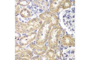 Immunohistochemistry of paraffin-embedded rat liver using HADH antibody at dilution of 1:100 (400x lens). (HADH 抗体)