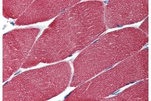 Immunohistochemistry staining of human muscle (paraffin-embedded sections) with anti-muscle-specific actin (HHF35). (Actin 抗体)