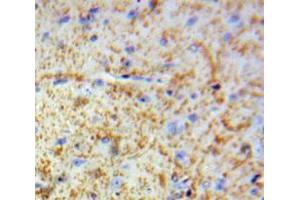 Used in DAB staining on fromalin fixed paraffin-embedded Brain tissue (MBP 抗体  (AA 220-301))