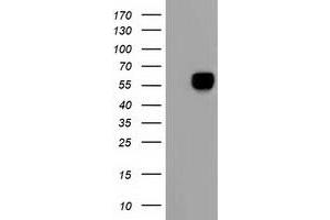 HEK293T cells were transfected with the pCMV6-ENTRY control (Left lane) or pCMV6-ENTRY AFP (Right lane) cDNA for 48 hrs and lysed. (alpha Fetoprotein 抗体)