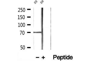 Western blot analysis of extracts of A549 cells, using LGALS3BP antibody. (LGALS3BP 抗体  (C-Term))