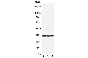 Western blot testing of COMT antibody and Lane 1:  HeLa;  2: A375;  3: PANC cell lysate. (COMT 抗体  (N-Term))