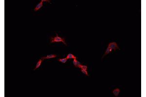 ABIN6268855 staining 293T  cells by IF/ICC.