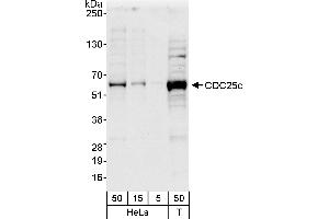 Western Blotting (WB) image for anti-Cell Division Cycle 25 Homolog C (S. Pombe) (CDC25C) (AA 150-200) antibody (ABIN7454534)