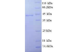 SDS-PAGE (SDS) image for Interferon gamma (IFNG) (AA 23-156) protein (GST tag) (ABIN5712984)