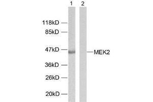 Western blot analysis of extracts from ovary cancer cells using MEK2 (Ab-394) antibody (E021008). (MEK2 抗体)