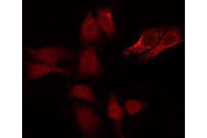 ABIN6267651 staining Hela by IF/ICC. (Caspase 8 抗体  (pSer347))