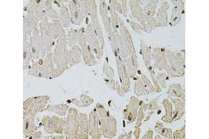 Immunohistochemistry of paraffin-embedded Mouse heart using FGF2 Polyclonal Antibody at dilution of 1:100 (40x lens). (FGF2 抗体)