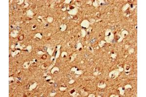 Immunohistochemistry of paraffin-embedded human brain tissue using ABIN7162627 at dilution of 1:100 (PNMA2 抗体  (AA 2-361))