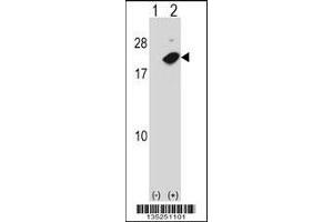 Western blot analysis of NUDT2 using rabbit polyclonal NUDT2 Antibody using 293 cell lysates (2 ug/lane) either nontransfected (Lane 1) or transiently transfected (Lane 2) with the NUDT2 gene. (NUDT2 抗体  (AA 62-90))