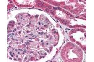 Immunohistochemistry (IHC) image for anti-Collagen, Type XVIII, alpha 1 (COL18A1) antibody (ABIN2470497)