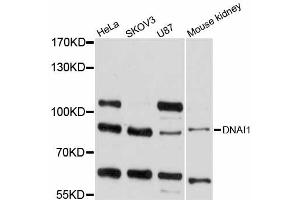 Western blot analysis of extracts of various cell lines, using DNAI1 antibody (ABIN5997592) at 1/1000 dilution. (DNAI1 抗体)
