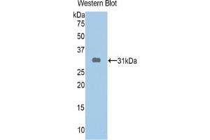 Western blot analysis of the recombinant protein. (ABCA1 抗体  (AA 1404-1663))