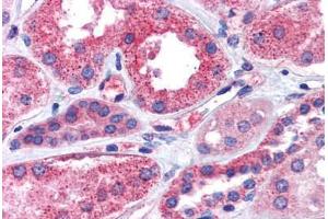 Kidney, Human: Formalin-Fixed, Paraffin-Embedded (FFPE) (IGSF8 抗体  (Internal Region))