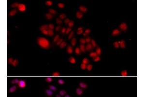 Immunofluorescence (IF) image for anti-DnaJ (Hsp40) Homolog, Subfamily B, Member 6 (DNAJB6) antibody (ABIN7263009)