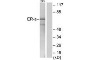 Western blot analysis of extracts from 293 cells, using Estrogen Receptor-alpha (Ab-537) Antibody. (Estrogen Receptor alpha 抗体  (AA 501-550))