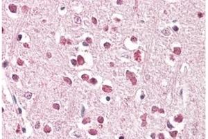 Image no. 1 for anti-XPA Binding Protein 2 (XAB2) (C-Term) antibody (ABIN374084) (XAB2 抗体  (C-Term))