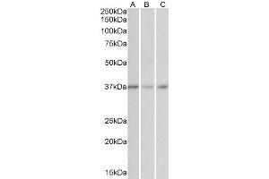 ABIN571105 (0. (GHITM 抗体  (Internal Region))