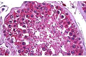 Human Testis: Formalin-Fixed, Paraffin-Embedded (FFPE) (PDK2 抗体  (AA 187-276))