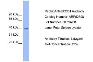 WB Suggested Anti-EXOD1  Antibody Titration: 0. (ERI2 抗体  (N-Term))