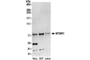 Western Blotting (WB) image for anti-Myotubularin Related Protein 1 (MTMR1) (AA 615-665) antibody (ABIN7450466)