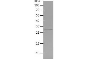 Western Blotting (WB) image for Brain Protein 44 (BRP44) (AA 1-40) protein (His-IF2DI Tag) (ABIN7282359) (BRP44 Protein (AA 1-40) (His-IF2DI Tag))