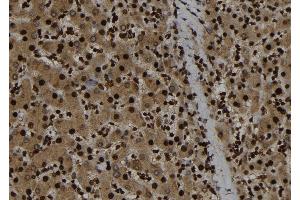 ABIN6263929 and ABIN6273282 at 1/100 staining Human liver tissue by IHC-P. (p107 抗体  (C-Term))