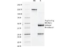 SDS-PAGE Analysis Purified CD61 Monoclonal Antibody (Y2/51). (Integrin beta 3 抗体)